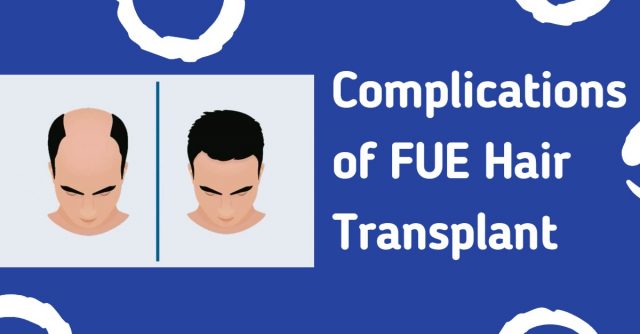Complications of FUE Hair Transplant